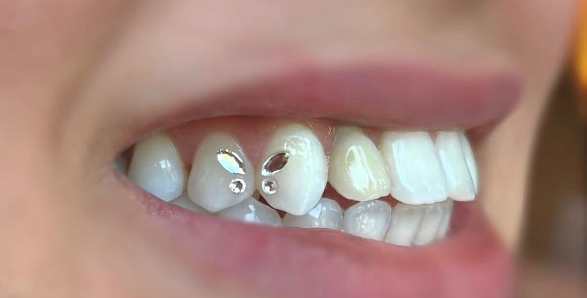 Tanddiamant 2 steentjes
